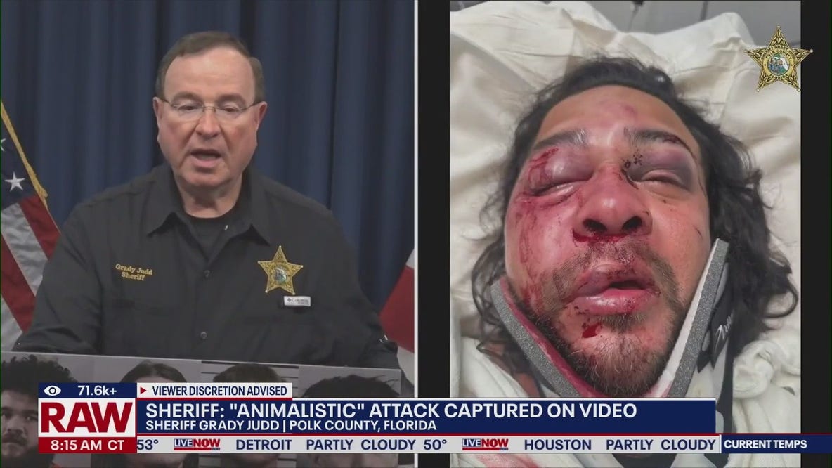 4 teens arrested after 'brutal beating' puts man in ICU